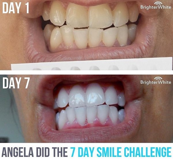 Angela - customer before and after photo