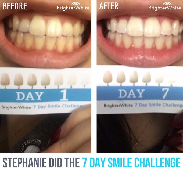 Stephanie - customer before and after photo