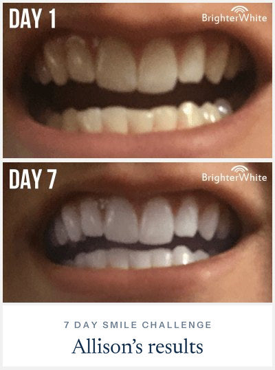 Allison Ā· 7 Day Smile Challenge