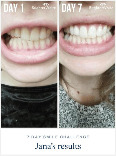 Jana Ā· 7 Day Smile Challenge