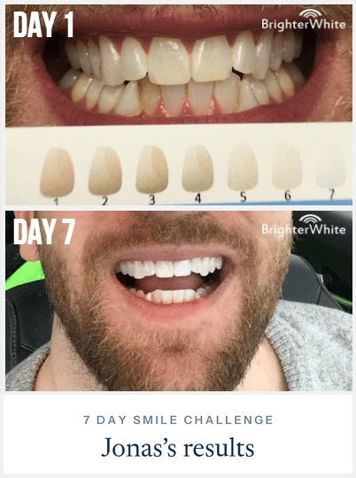 Jonas Ā· 7 Day Smile Challenge