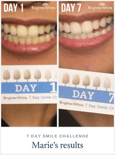 Marie Ā· 7 Day Smile Challenge