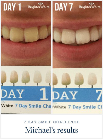 Michael Ā· 7 Day Smile Challenge
