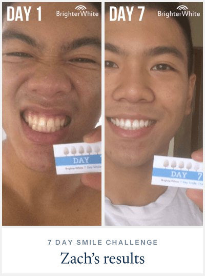 Zach Ā· 7 Day Smile Challenge