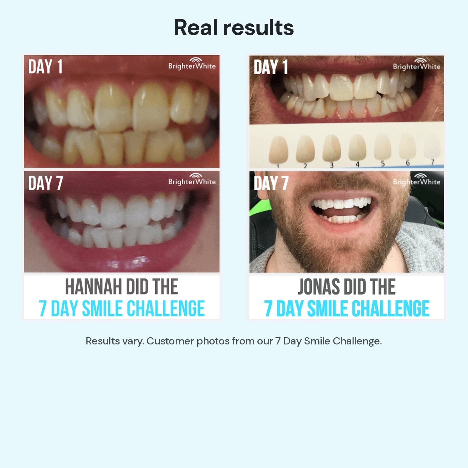 Real customer results from the 7 Day Smile Challenge - results vary