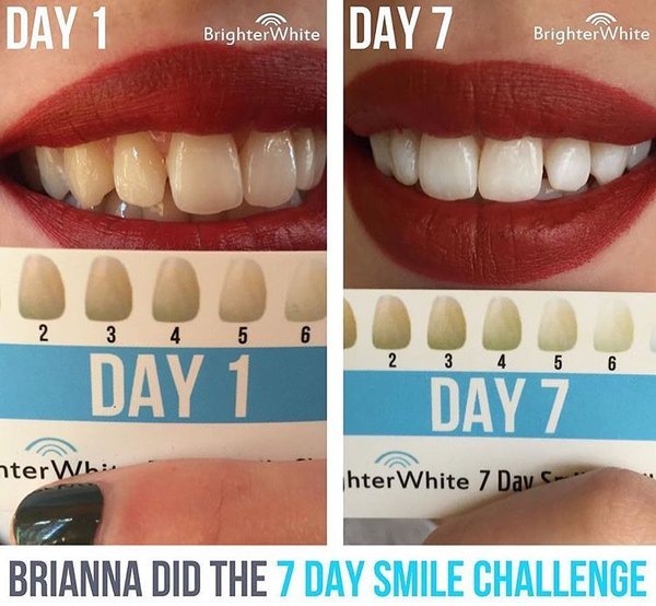 Brianna - customer before and after photo