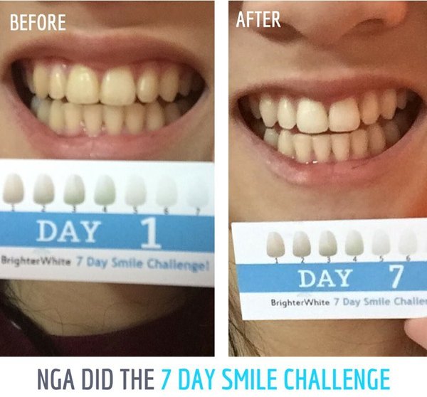 Nga - customer before and after photo