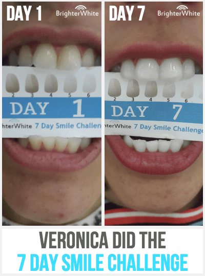 Veronica - day 1 vs day 7 result