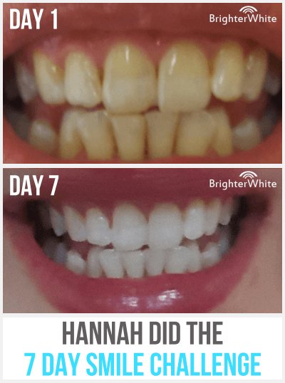 Hannah - day 1 vs day 7 result