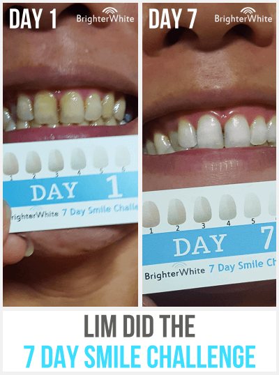 Lim - day 1 vs day 7 result