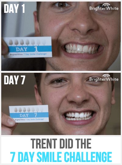 Trent - day 1 vs day 7 result