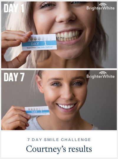 Courtney - day 1 vs day 7 result, 7 Day Smile Challenge