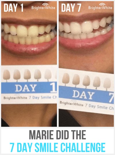 Marie · 7 Day Smile Challenge