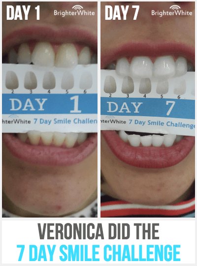 Veronica · 7 Day Smile Challenge